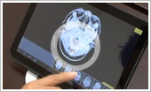 タブレット端末を用いた医用画像高速伝送表示システム「Smart MIMAS」